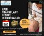 Affordable Hair Transplant Centre in Hyderabad