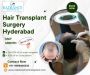 Hair Transplant Surgery in Hyderabad – Book Now
