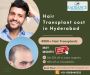 Best Hair Transplant Cost Hyderabad | Compare & Save