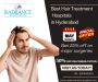 Best Hair Treatment Hospitals in Hyderabad
