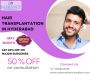 Hair Transplantation in Hyderabad