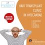 Hair Transplantation Clinic in Hyderabad