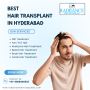 Best Hair Transplant in Hyderabad