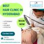 Find Hyderabad Best Hair Transplant Clinic