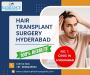 Affordable Hair Transplant Surgery in Hyderabad 
