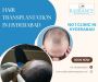 Best Hair Transplantation in Hyderabad