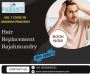 Hair Replacement Services Rajahmundry - Book Now