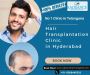  Best Hair Transplantation Clinic in Hyderabad