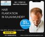 Hair Transplant Cost in Rajahmundry – What to Expect