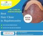 Find Best Hair Clinic in Rajahmundry