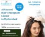 Advanced Hair Transplant Center in Hyderabad
