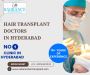 Best Hair Transplant Doctors in Hyderabad 