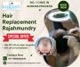 Natural-Looking Hair Replacement in Rajahmundry