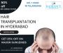 Top Hair Transplant Services in Hyderabad 
