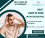 Effective Hair Loss Treatment in Hyderabad