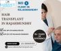 Advanced Hair Transplant in Rajahmundry – Book Now