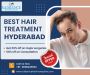 Best Hair Treatment Hyderabad