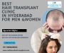 Top Hair Transplant Clinic in Hyderabad for Men & Women 