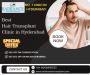 Best Hair Treatment Hospital in Hyderabad