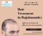 Best Hair Transplant Surgery in Rajahmundry 
