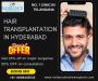 Find Best Hair Clinic in Hyderabad 