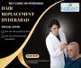 Hair Replacement Services Hyderabad 