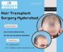 Hair Transplant in Hyderabad | Radiance Hair Clinic