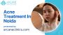 Acne Treatment In Noida | Arcane Clinics