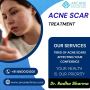 Acne Scar Treatment in Noida | Arcane Clinics