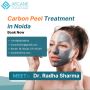 Best Carbon Peel Treatment in Noida