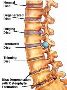 Spondylosis Treatment In Pune