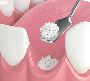 Understanding Gum Disease: Insights from Stirling’s Leading