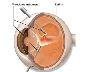 Retina Eye Surgery In Delhi Enhancing Vision and Restoring 