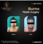 Restore your skin after Burn Injuries - Dr. Subhash Center f