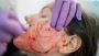 Vampire Facial: The Secret to Glowing and Youthful Skin