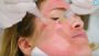 Rejuvenate Your Skin with PRP: The Ultimate Vampire Facial 