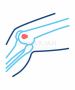 Best Bone Cancer  Treatment Hospitals in  Bangalore