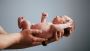 Neonatologist in Mumbai