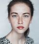 Bangalore's Top Pigmentation Services 
