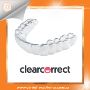 ClearCorrect