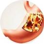 Manhattan Gastroenterology | Colonoscopy Specialists | Best 
