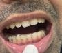 Lock jaw treatment Mumbai