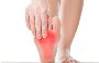 Compassionate Plantar Fasciitis Care in Houston