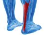 Expert Achilles Tendon Specialist in Houston, TX