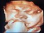 Get Affordable Ultrasound Service in New York City, USA Get Affordable Ultrasound Service in New York City, USA