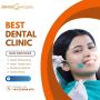 Get the Best Dental Implants in Santacruz Today