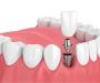 Best Dental Clinic in Panchyawala