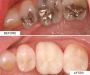 Dental Clinic in Hanuman Nagar