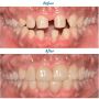 Revolutionise your Dental Career with Squat Practice at Dent
