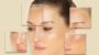 Best Skin Care Clinic in Bangalore - Dermaqure